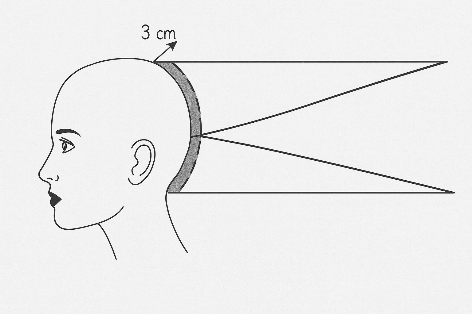 Ilustrasi root touch-up di bagian akar